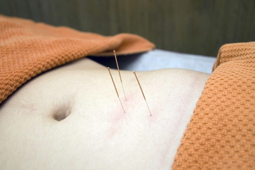 Acupuncture ou médecine occidentale ?